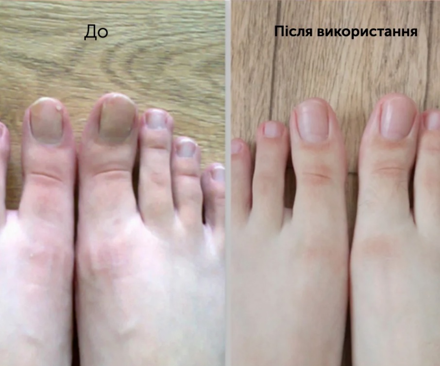 результат